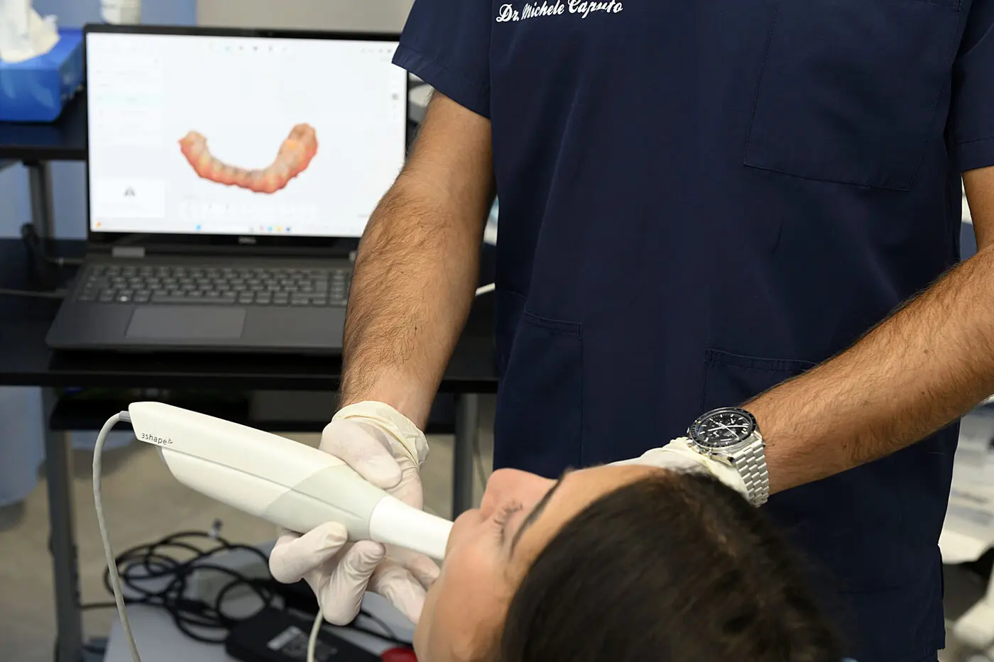 Scanner Intraorale